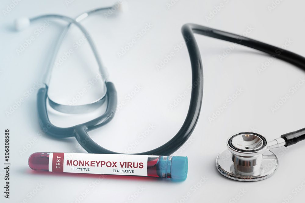 monkeypox india today